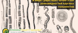 Small white worms in humans: types and characteristics